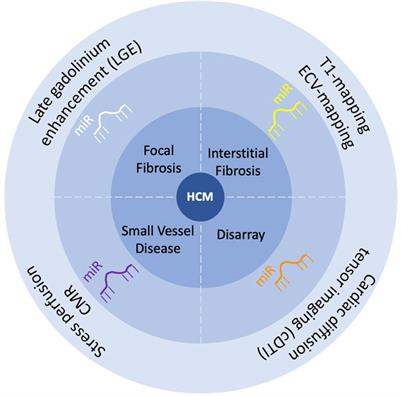 Circulating microRNA as promising biomarkers in hypertrophic cardiomyopathy: can advanced cardiac magnetic resonance unlock new insights in research?